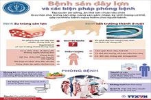 [Infographics] Bệnh sán dây lợn và các biện pháp phòng bệnh
